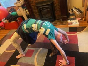 Amy doing a backbend in her Whisper brace